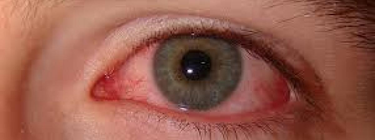Eyecare scheme extended throughout Southern Trust area Eyecare scheme extended throughout Southern Trust area
