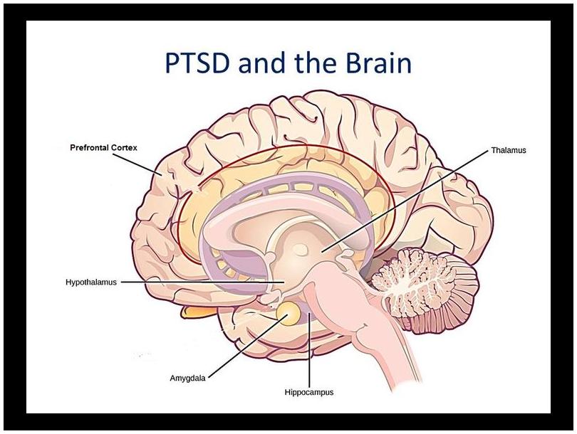 PTSD and the brain